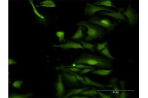 Immunofluorescence of purified MaxPab antibody to TRIM35 on HeLa cell. (TRIM35 抗体  (AA 1-493))