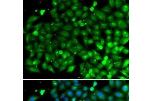 Immunofluorescence analysis of A549 cells using SH3GLB1 Polyclonal Antibody (SH3GLB1 抗体)