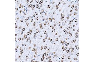 IHC analysis of VPRBP/DCAF1 using anti-VPRBP/DCAF1 antibody (ABIN7602005). (DDB1 and CUL4-Associated Factor 1 (DCAF1) (AA 540-861) 抗体)