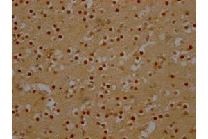 IHC image of ABIN7127452 diluted at 1:100 and staining in paraffin-embedded human brain tissue performed on a Leica BondTM system. (Recombinant DDX6 抗体)