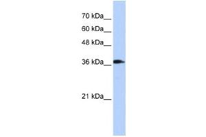 Western Blotting (WB) image for anti-ATPase, H+ Transporting, Lysosomal 38kDa, V0 Subunit D2 (ATP6V0D2) antibody (ABIN2459920) (ATP6V0D2 抗体)