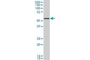 PRPF19 monoclonal antibody (M07), clone 2E5. (PRP19 抗体  (AA 1-90))