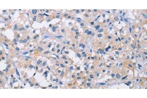 Immunohistochemistry (Paraffin-embedded Sections) (IHC (p)) image for anti-ATPase, H+ Transporting, Lysosomal Accessory Protein 2 (ATP6AP2) antibody (ABIN7240880)