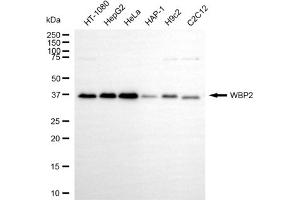 Western blotting analysis using WBP2 antibody (ABIN7800868). (WBP2 抗体)