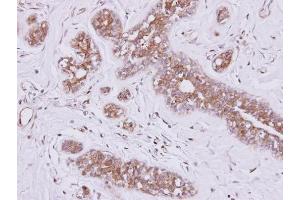 Immunohistochemistry (IHC) image for anti-Fibronectin Type III and SPRY Domain Containing 2 (FSD2) (N-Term) antibody (ABIN2856438)