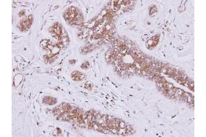 IHC-P Image Immunohistochemical analysis of paraffin-embedded SAOS-2 xenograft, using FSD2, antibody at 1:500 dilution. (FSD2 抗体  (N-Term))