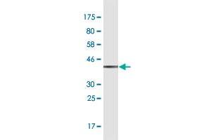 Western Blot detection against Immunogen (37. (GBF1 抗体  (AA 101-209))