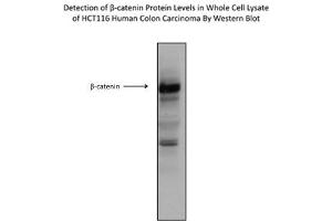 Western Blotting (WB) image for anti-Catenin (Cadherin-Associated Protein), beta 1, 88kDa (CTNNB1) (C-Term) antibody (ABIN2792527)