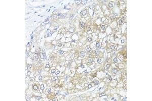 Immunohistochemistry (IHC) image for anti-Argininosuccinate Lyase (ASL) (AA 1-300) antibody (ABIN6137201)