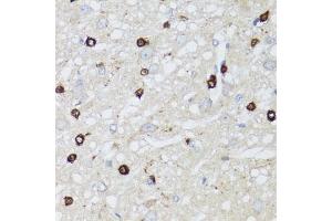 Immunohistochemistry of paraffin-embedded rat brain using MIP antibody (ABIN3016917, ABIN3016918, ABIN3016919 and ABIN6219879) at dilution of 1:100 (40x lens). (Mip (AA 50-150) 抗体)