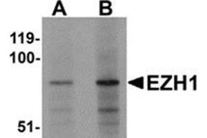 Western blot analysis of EZH1 in mouse lung tissue lysate with EZH1 antibody at (A) 1 and (B) 2 μg/ml. (EZH1 抗体  (N-Term))