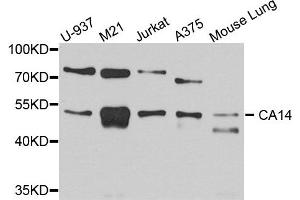 Western blot analysis of extract of various cells, using CA14 antibody. (CA14 抗体)