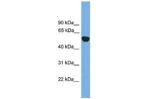 EPHX1 antibody used at 1 ug/ml to detect target protein. (EPHX1 抗体)
