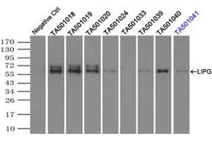 Image no. 2 for anti-Lipase, Endothelial (LIPG) antibody (ABIN1499167) (LIPG 抗体)