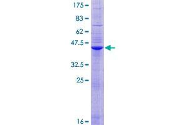 SLC11A1 Protein (AA 1-178) (GST tag)