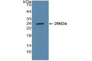 Detection of Recombinant CCNB, Human using Polyclonal Antibody to Cyclin B (CCNB) (Cyclin B1 抗体  (AA 239-433))