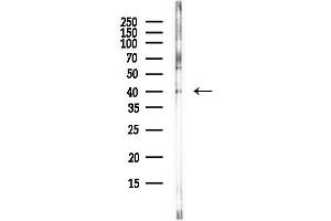 Western blot analysis of lysates from PC12 cells(LPS, 4h treatment), using CDK9 Antibody at 1/1000 dilution.