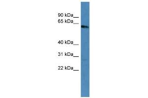 WB Suggested Anti-KRT3 Antibody Titration: 0. (Keratin 3 抗体  (C-Term))