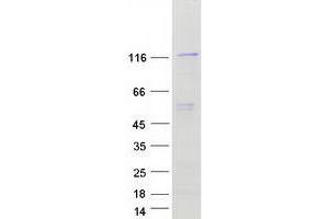 NAT10 Protein (Transcript Variant 1) (Myc-DYKDDDDK Tag)