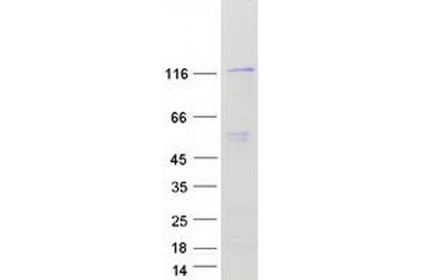 NAT10 Protein (Transcript Variant 1) (Myc-DYKDDDDK Tag)