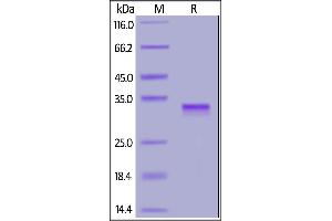 SARS-CoV-2 S protein RBD, His Tag on  under reducing (R) condition.