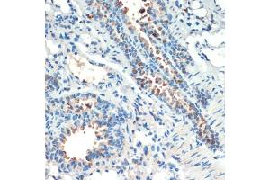 Immunohistochemistry of paraffin-embedded mouse lung using RPS6K antibody (ABIN6129296, ABIN6147232, ABIN6147233 and ABIN6214270) at dilution of 1:200 (40x lens). (MSK2 抗体  (AA 1-220))