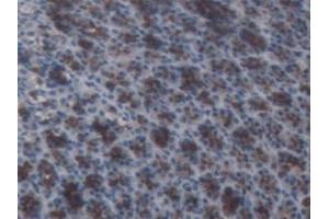 IHC-P analysis of Rat Stomach Tissue, with DAB staining. (AGT 抗体)