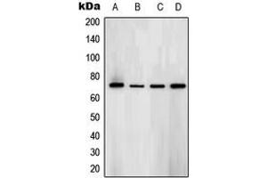 Western blot analysis of SYK (pY323) expression in BJAB (A), Ramos (B), NAMALWA (C), Raw264.