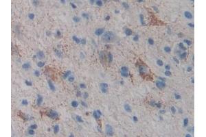 Immunohistochemistry (IHC) image for anti-Cytochrome P450, Family 21, Subfamily A, Polypeptide 2 (CYP21A2) (AA 106-389) antibody (ABIN7441886)