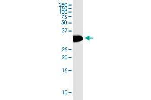 HSD17B12 monoclonal antibody (M08), clone 4G11. (HSD17B12 抗体  (AA 203-271))