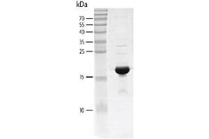 Recombinant CREBBP (1081-1197) protein gel. (CBP Protein (AA 1081-1197) (His tag,DYKDDDDK Tag))