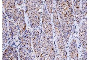 IHC analysis of Cdk2 using anti-Cdk2 antibody (ABIN7602522).