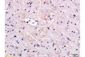 Formalin-fixed and paraffin embedded rat brain labeled with Anti GPR55 Polyclonal Antibody, Unconjugated (ABIN872750) at 1:200 followed by conjugation to the secondary antibody and DAB staining.