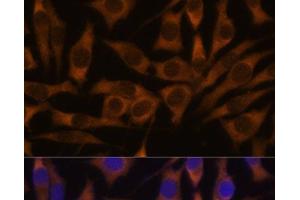 Immunofluorescence analysis of L929 cells using IGF2BP3 Polyclonal Antibody at dilution of 1:100. (IGF2BP3 抗体)