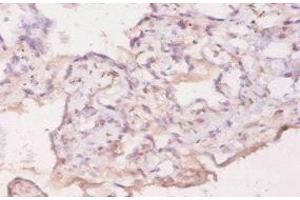 Immunohistochemistry of paraffin-embedded human placenta tissue using ABIN7177253 at dilution of 1:20 (GDF5 抗体  (AA 376-495))