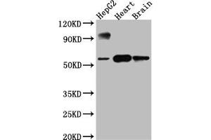 Western Blot Positive WB detected in: HepG2 whole cell lysate, Rat Heart whole cell lysate, Rat Brain whole cell lysate All lanes: CYP17A1 antibody at 1:1000 Secondary Goat polyclonal to rabbit IgG at 1/50000 dilution Predicted band size: 58 kDa Observed band size: 58 kDa (Recombinant CYP17A1 抗体)