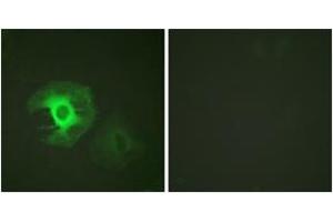 Immunofluorescence analysis of HeLa cells, using Caldesmon (Ab-789) Antibody. (Caldesmon 抗体  (AA 744-793))