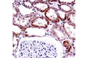 CD70 antibody immunohistochemistry analysis in formalin fixed and paraffin embedded human kidney tissue. (CD70 抗体  (AA 72-101))
