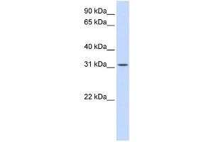 WB Suggested Anti-BCAS2 Antibody Titration:  0. (BCAS2 抗体  (Middle Region))