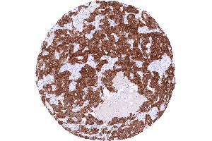 Immunohistochemistry (IHC) image for anti-Glutamate Decarboxylase 2 (Pancreatic Islets and Brain, 65kDa) (GAD2) (AA 6-99) antibody (ABIN7477477)