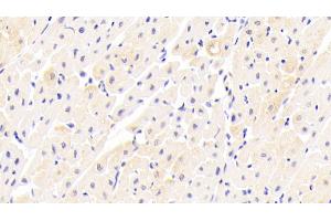 Detection of FNDC5 in Human Cardiac Muscle Tissue using Polyclonal Antibody to Fibronectin Type III Domain Containing Protein 5 (FNDC5) (FNDC5 抗体  (AA 2-137))