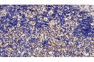 Immunohistochemistry (IHC) image for anti-Signal Transducer and Activator of Transcription 1, 91kDa (STAT1) (AA 343-602) antibody (ABIN7443806)