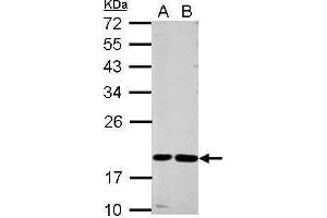 WB Image Sample (30 ug of whole cell lysate) A: A549 B: MCF-7 12% SDS PAGE antibody diluted at 1:1000 (CST7 抗体)