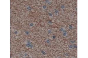 Used in DAB staining on fromalin fixed paraffin- embedded Kidney tissue (IL20RA 抗体  (AA 269-545))