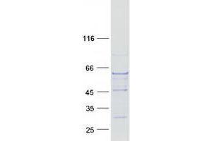 Validation with Western Blot