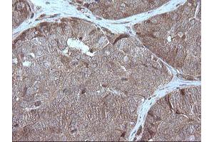 Image no. 1 for anti-Mitogen-Activated Protein Kinase Kinase 1 (MAP2K1) antibody (ABIN1499381) (MEK1 抗体)
