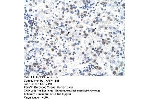 Rabbit Anti-FECH Antibody  Paraffin Embedded Tissue: Human Liver Cellular Data: Hepatocytes Antibody Concentration: 4. (FECH 抗体  (N-Term))