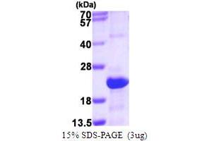SDS-PAGE (SDS) image for serglycin (SRGN) (AA 28-158) protein (His tag) (ABIN667582)