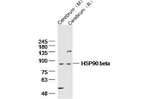 Lane 1: mouse cerebrum lysates Lane 2: rat cerebrum lysates probed with HSP90 beta Polyclonal Antibody, Unconjugated  at 1:300 dilution and 4˚C overnight incubation. (HSP90AB1 抗体  (AA 635-724))