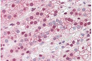 Human Adrenal: Formalin-Fixed, Paraffin-Embedded (FFPE) (GBP6 抗体  (C-Term))